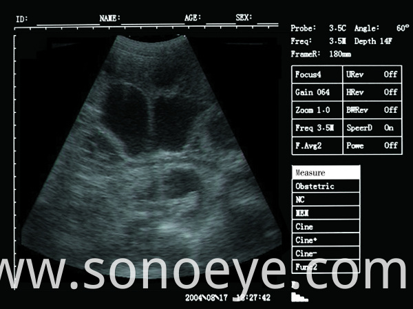 v5 pet ultrasound